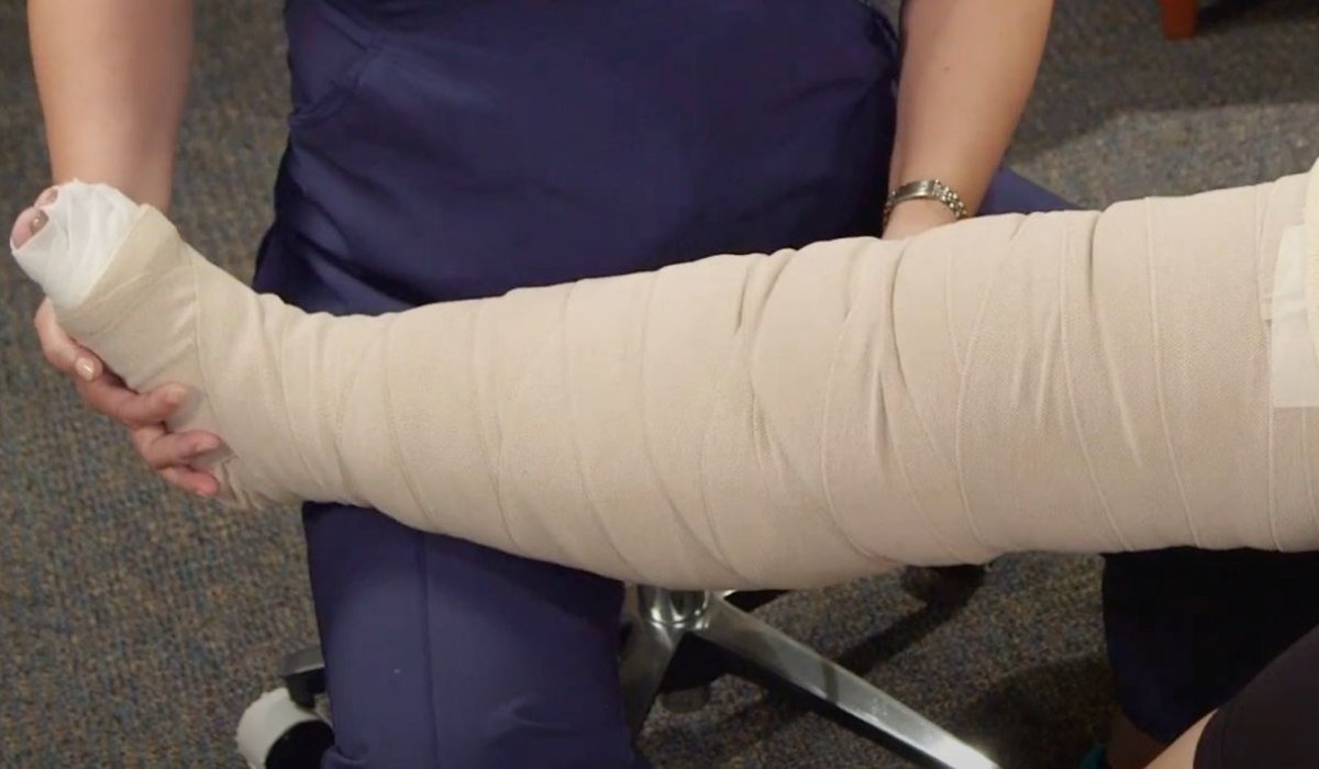 Traditional treatment: saphenous vein